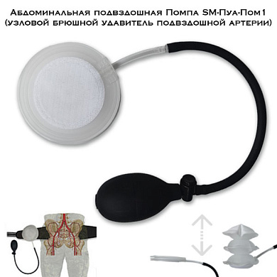 Абдоминальная подвздошная Помпа SM-Пуа-Пом1 (узловой брюшной удавитель подвздошной артерии)