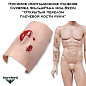 Носимое имитационное ранение СурвМед ФальшРана мод.Rezin “Открытый перелом плечевой кости руки”