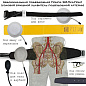 Абдоминальный подвздошный Пояс турникет SM-Пуа-Пояс1 (узловой брюшной удавитель подвздошной артерии)