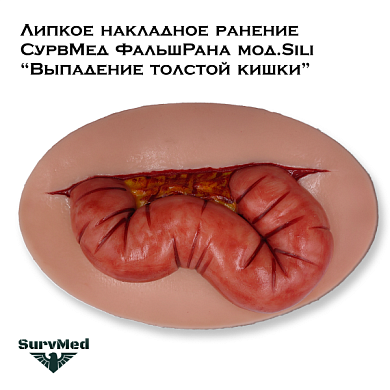 Липкое накладное ранение СурвМед ФальшРана мод.Sili “Выпадение толстой кишки” (одна большая поперечно ободочная кишка)